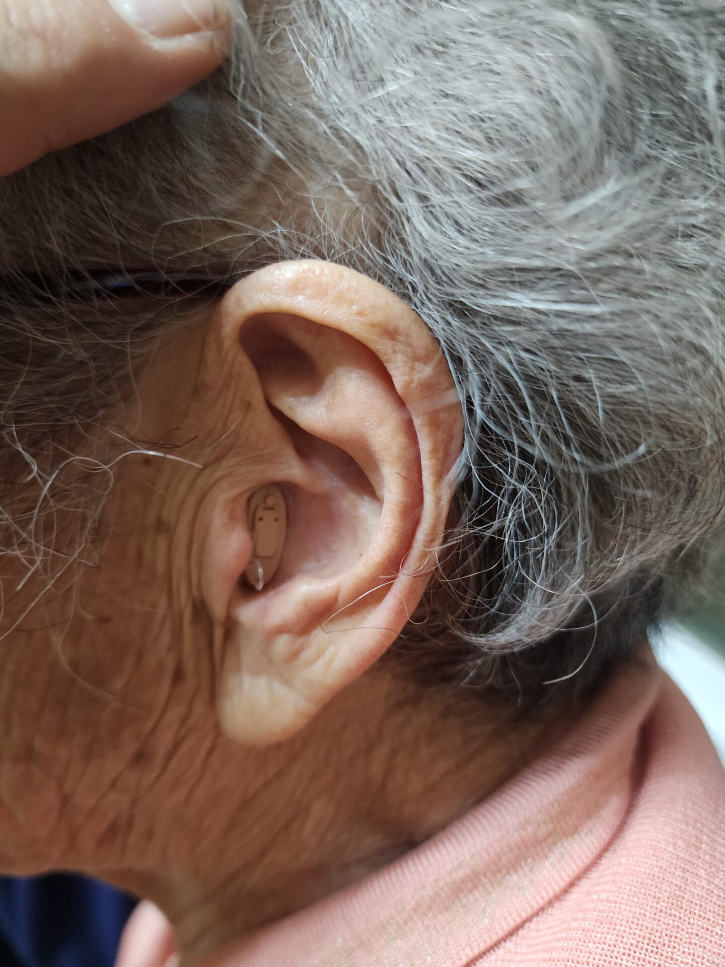 난청 방치하면 생기는 충격적인 변화 5가지